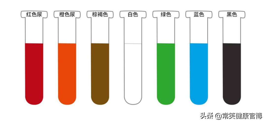 尿液淡黄色和深黄色的对比,尿液黄色和淡黄色的区别
