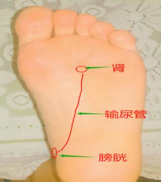 心绞痛的推拿疗法,足疗手法治疗心绞痛