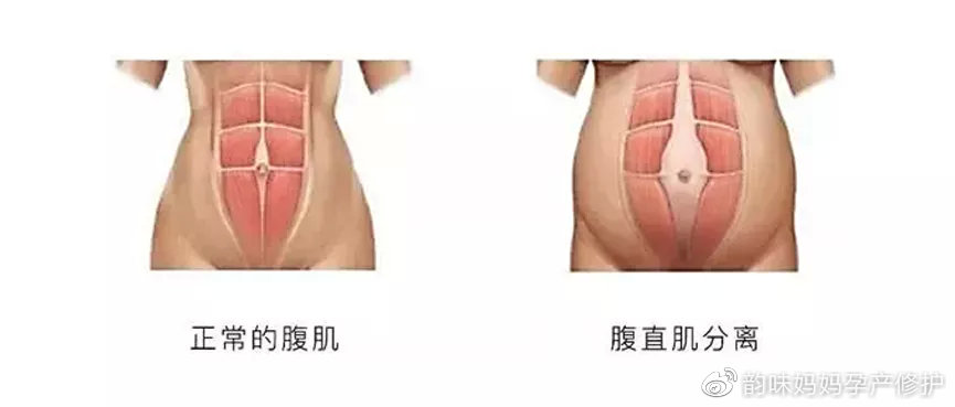 产后妈妈面临的烦恼有哪些,产后妈妈的痛点和需求