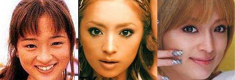 这个你察觉不到的小手术，滨崎步和80%的日本女星都做过它