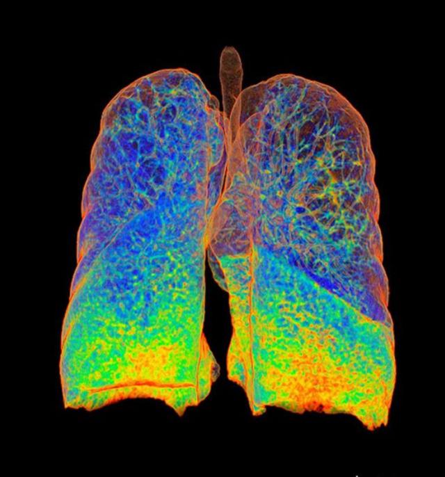 x射线下的人体图,x射线照片