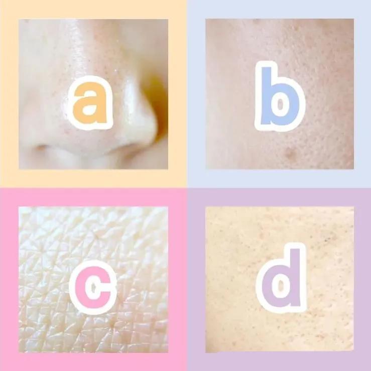 毛孔粗大推荐产品,最好用的收缩毛孔的产品