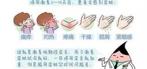 你的皮肤“恋上”激素了吗？