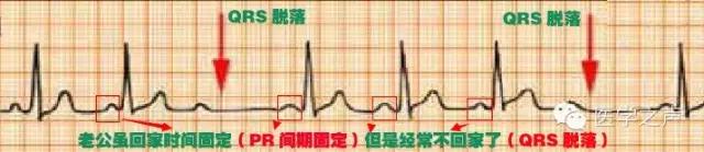 心电图学习入门书籍,心电图学习用书推荐