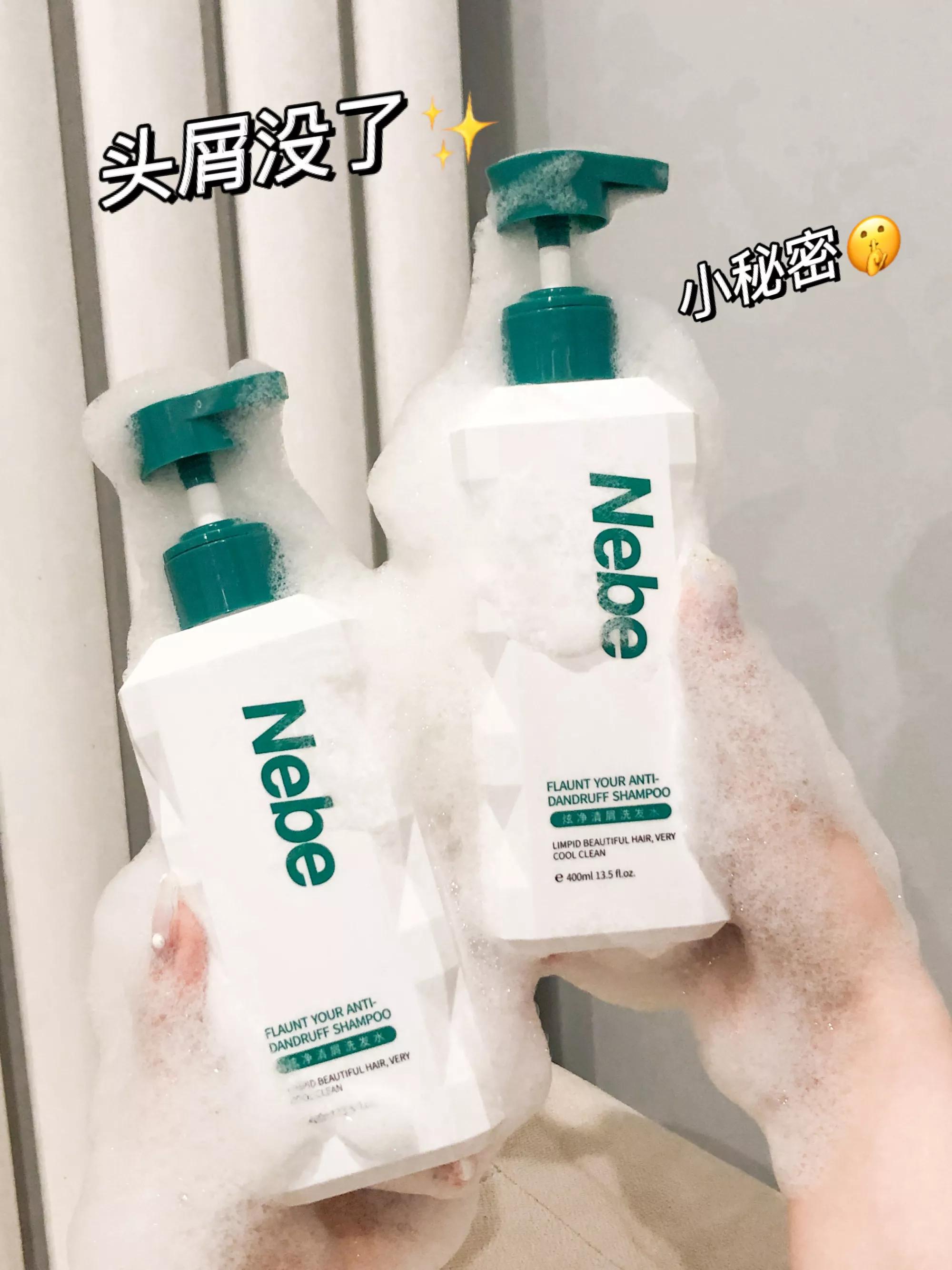 为什么从来没有头屑,你还在为头屑而烦恼吗