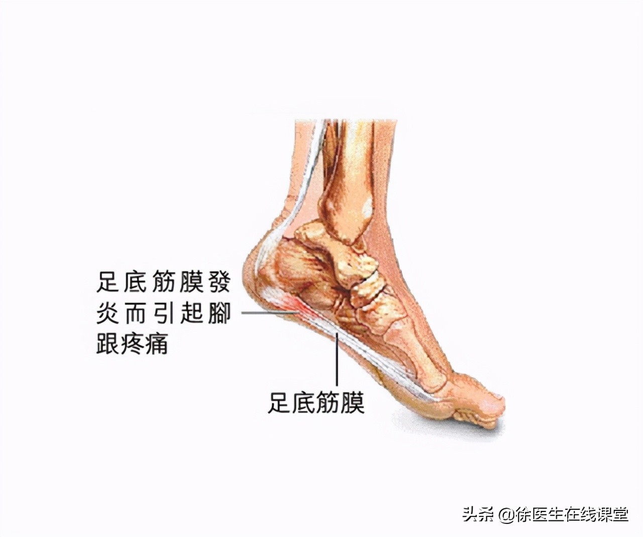 老年人脚底板疼怎么回事,老年人脚底板痛怎么回事怎么治