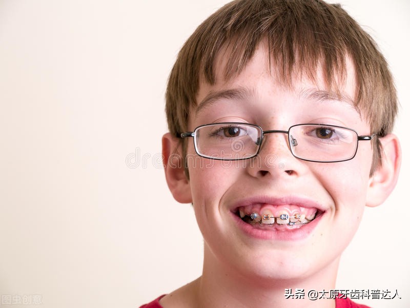 小孩子长龅牙咋办,龅牙有什么好解决的方法