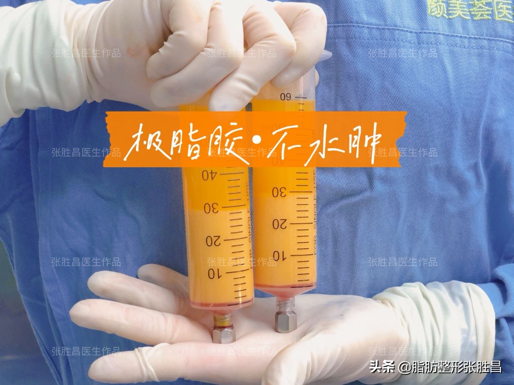 爱笑的女孩笑起来法令纹很明显,笑的时候有法令纹的人怎么样