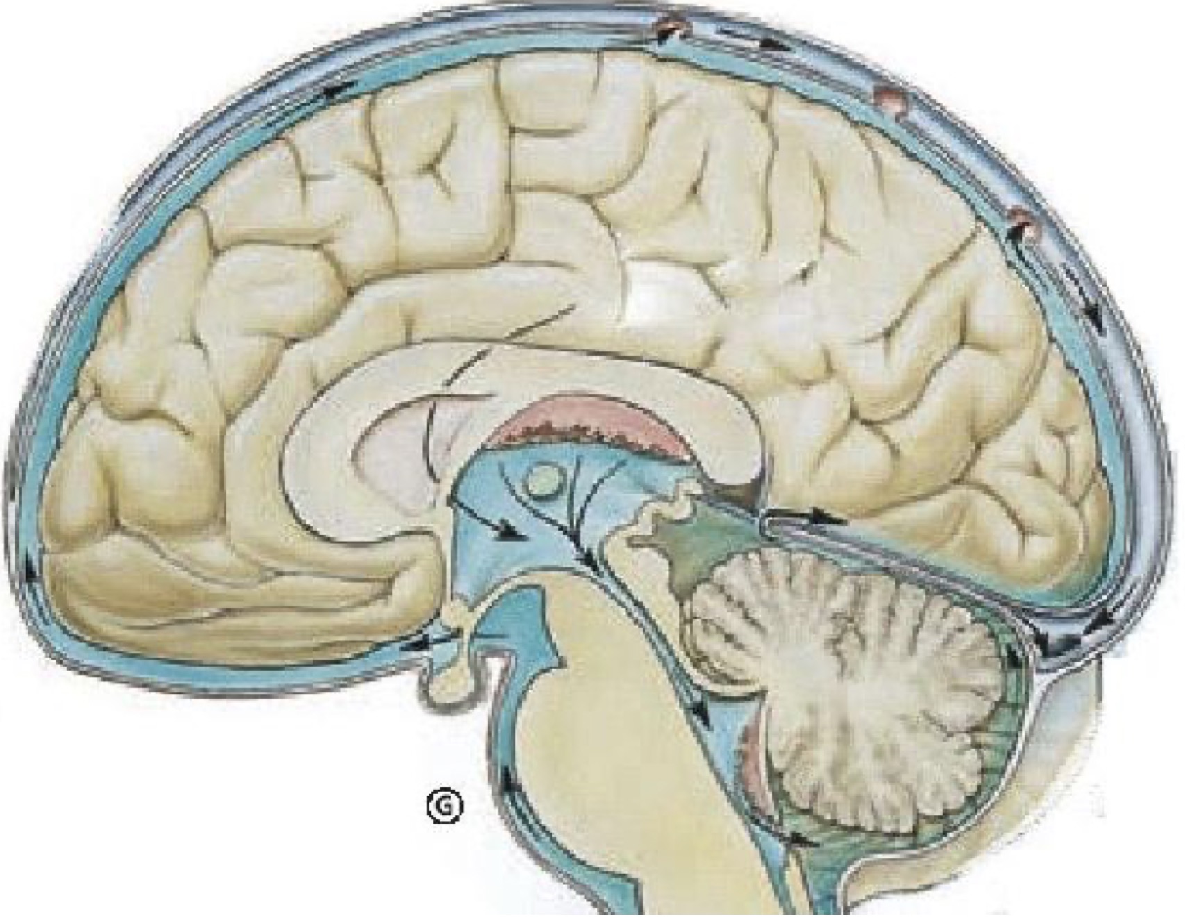 用头顶使劲撞墙会导致脑震荡么,自己用头撞墙会有脑震荡么