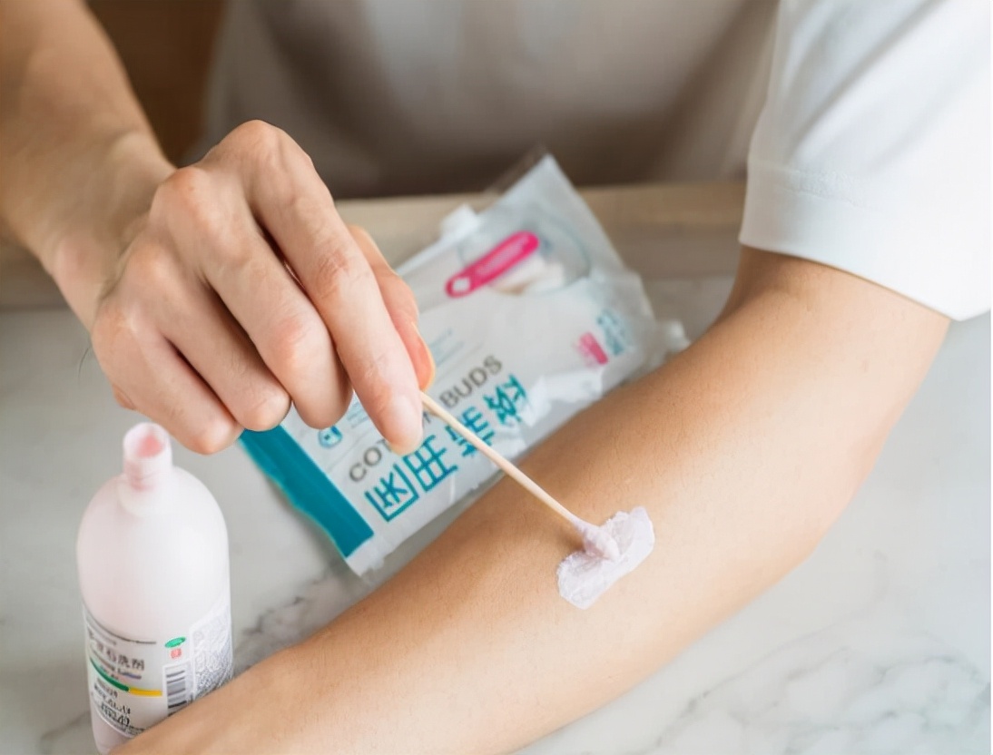 荨麻疹缓解瘙痒的方法是什么,荨麻疹瘙痒难忍可以用什么缓解