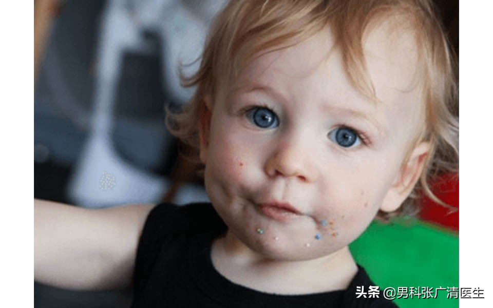 男性假两性畸形怎么选性别,男性假两性畸形是家族遗传吗