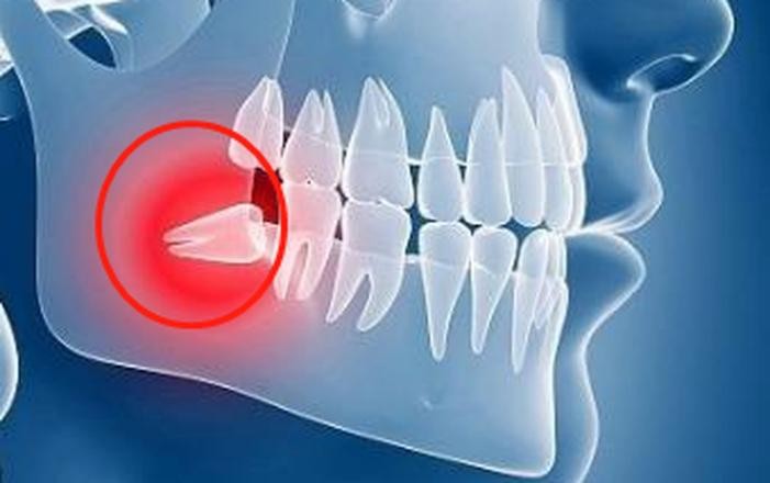 牙疼不是病但疼起来是真的要命,牙疼不是病疼痛起来可真要命