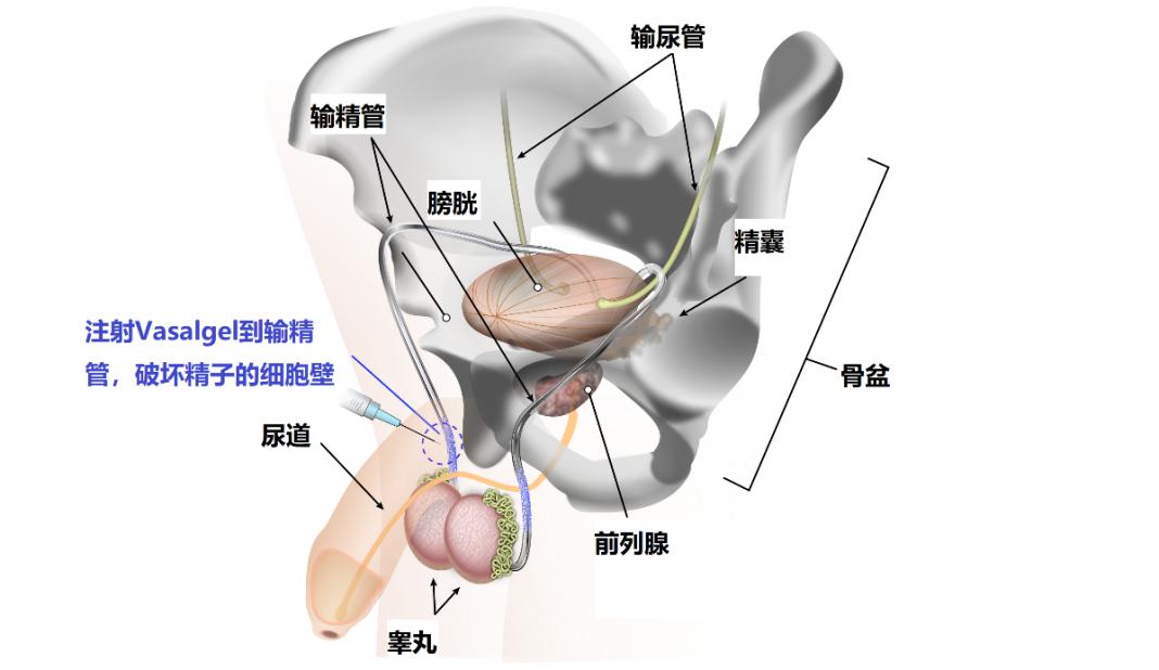 避孕药男性吃了有什么功效,男性吃避孕药会导致脱发吗