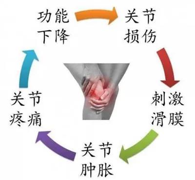 类风湿关节有积液可以打消炎针吗,类风湿关节积液消除最佳方法