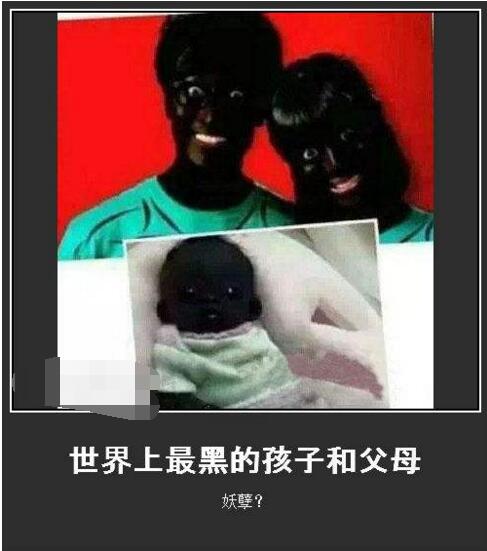 世界上最白的女孩和最黑的女孩,世界上最白的人和最黑的人图片