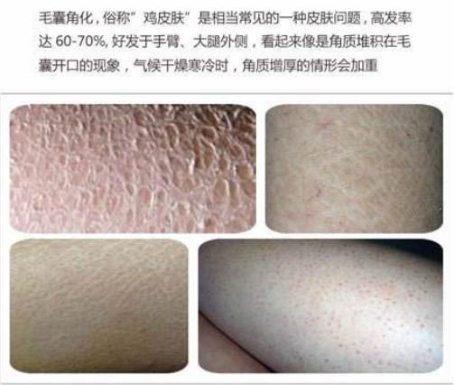 十大公认好用的身体乳排名,十大公认好用的身体乳测评