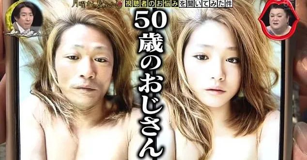 塌鼻梁鼻头大整容会有副作用吗,塌鼻梁凸嘴高颧骨整容