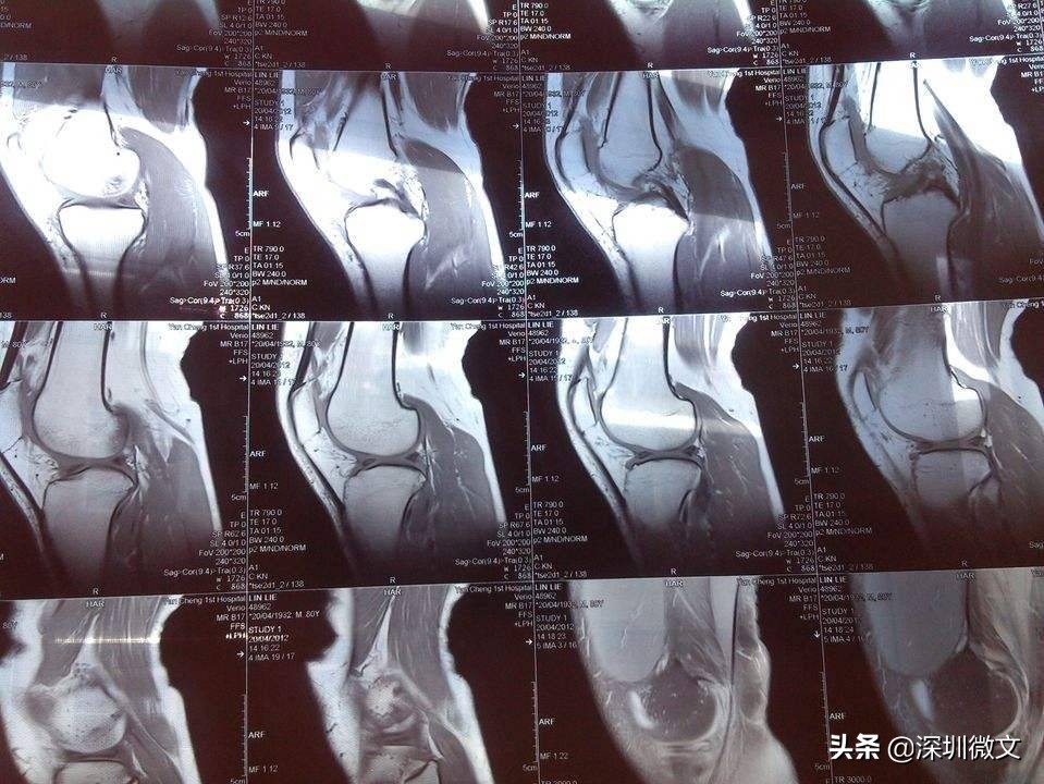 核磁共振原理和ct有什么区别,x光核磁ct的区别图片