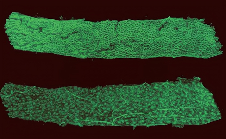 电鳗为什么不怕高压电,电鳗是怎么放电的怎么电不到自己