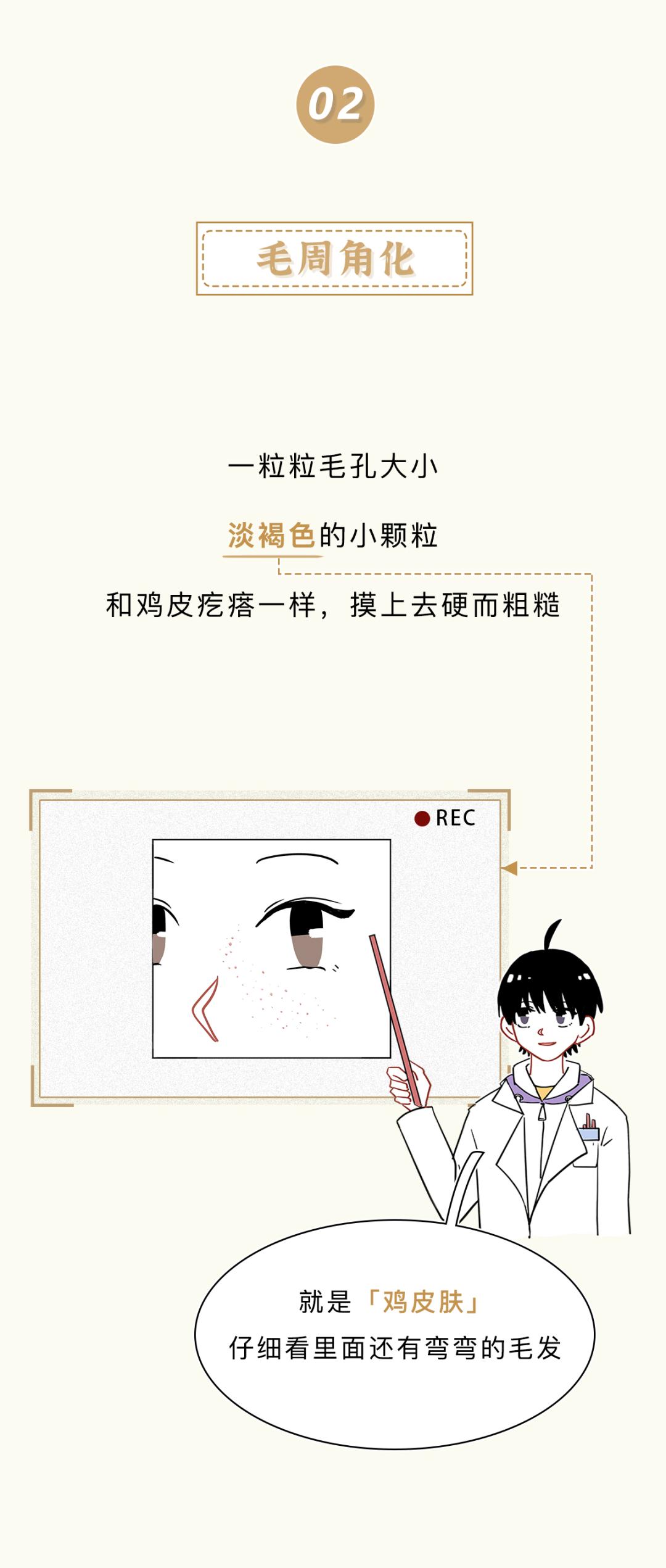 眼睛周围的脂肪粒到底是啥,小孩眼睛周围长很多脂肪粒