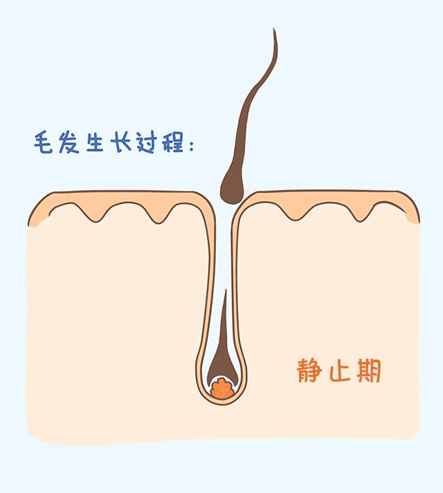 一天掉多少头发才算是脱发,一天掉多少根头发算严重脱发