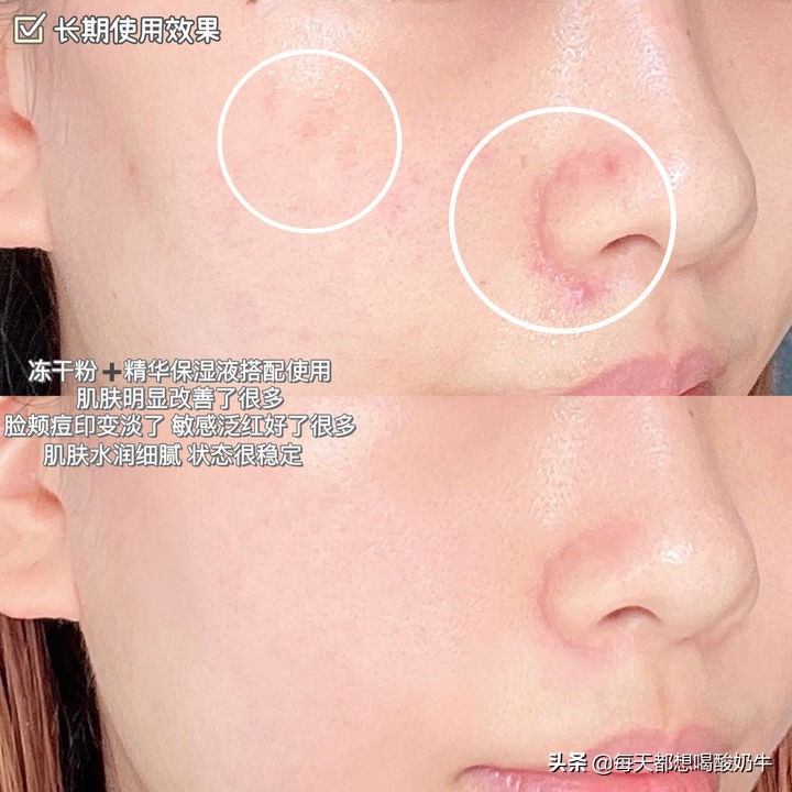 适合夏季用的清爽型爽肤水,夏天到了有什么好用的爽肤水推荐