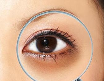 简单有效缓解黑眼圈的两个小方法,坚持用这四种方法有效缓解黑眼圈