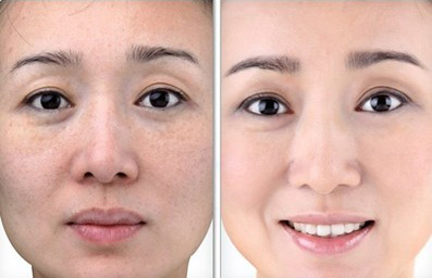 护肤品用单品还是套盒好,护肤品是买套装好还是自己搭配好