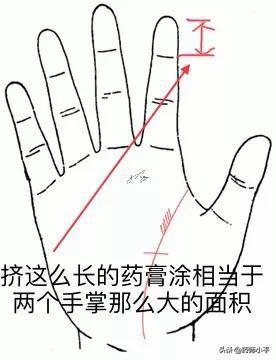 湿疹皮炎涂药后多久能好,皮炎湿疹用什么药立竿见影