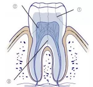 牙齿隐裂拔牙需要种植吗,牙齿裂一半深度还需要拔牙吗