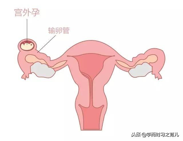 怀孕的危险期和安全期,怀孕期间最危险的事