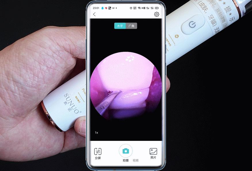 智能可视超声波洁牙仪洗牙步骤,牙科用的超声波洁牙设备