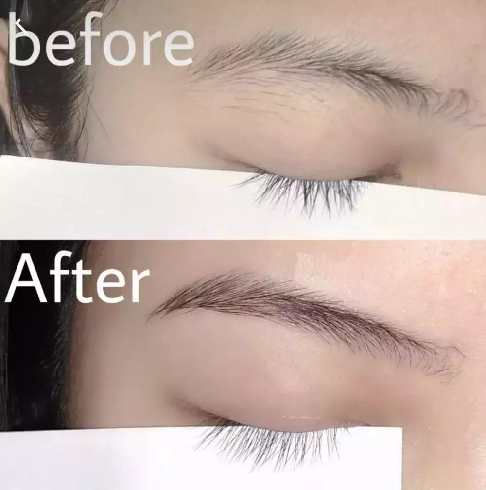 欧阳娜娜擦的药膏,欧阳娜娜擦什么药膏