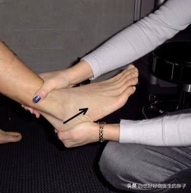 踝关节骨折大部分都需要做手术吗,踝关节骨折手术粘连的症状有哪些