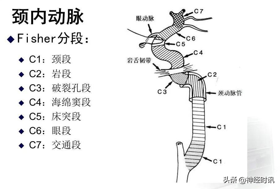 脑动脉解剖学讲解,基底节区脑血管解剖