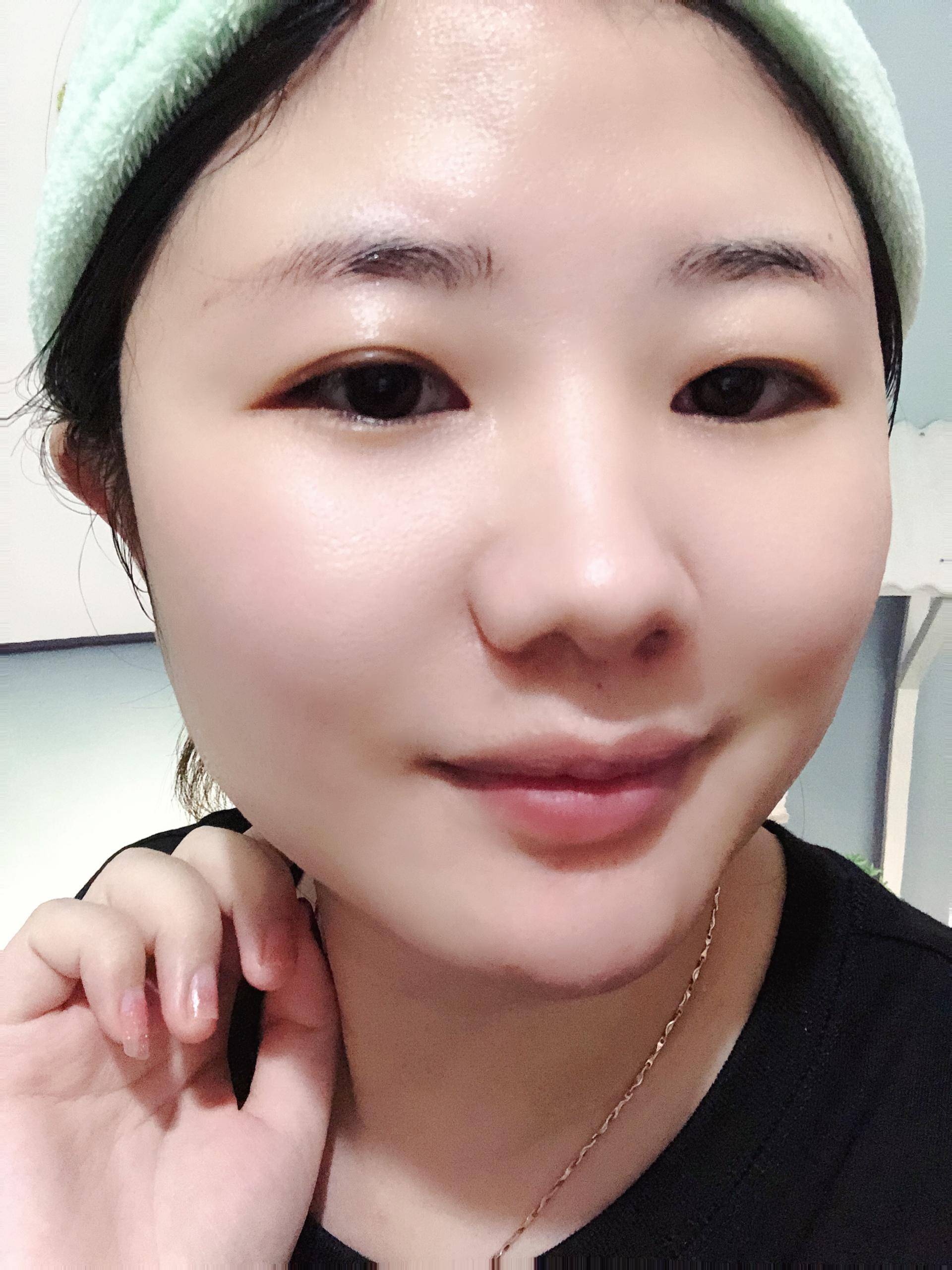 脸部医用冷敷贴怎么用效果好,面部护理冷敷贴