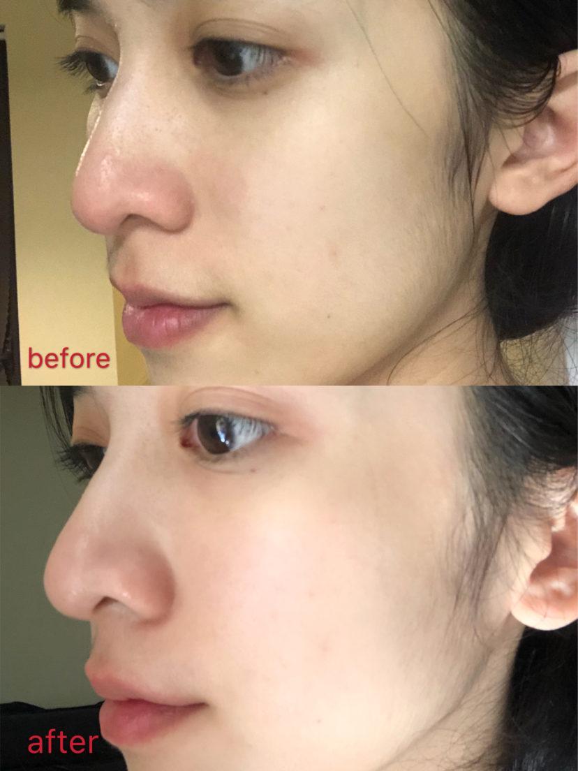 欧阳娜娜和周冬雨是什么关系,28岁的周冬雨图片