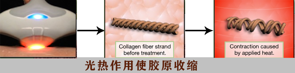 激光美容有哪些项目,激光美容都有哪些项目