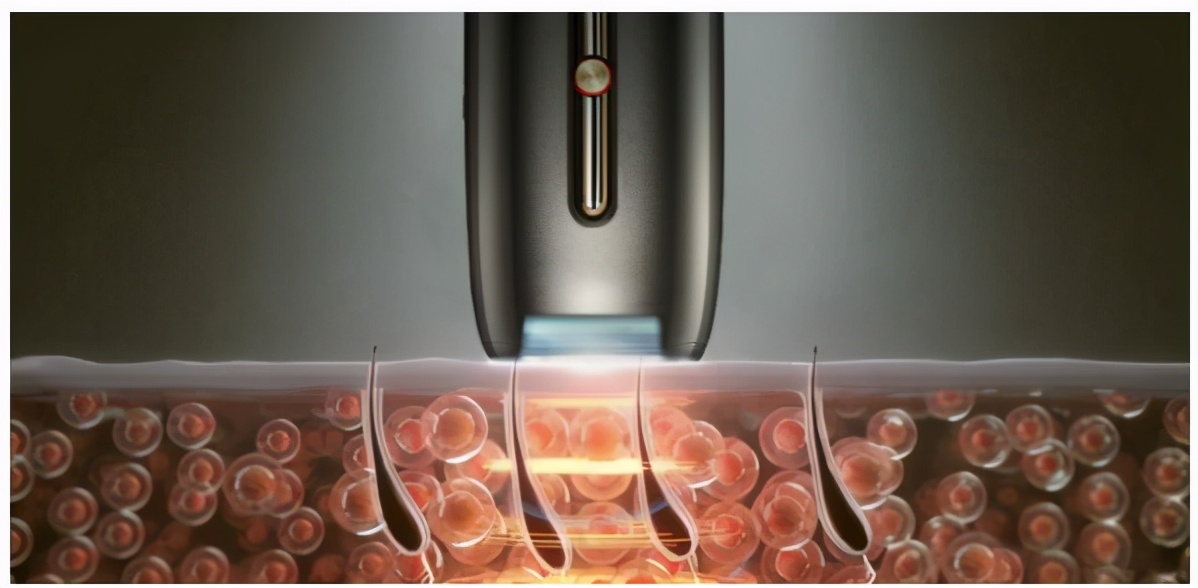 ulike脱毛仪ul06pr和ul06br有啥区别,什么脱毛仪能达到ulike效果