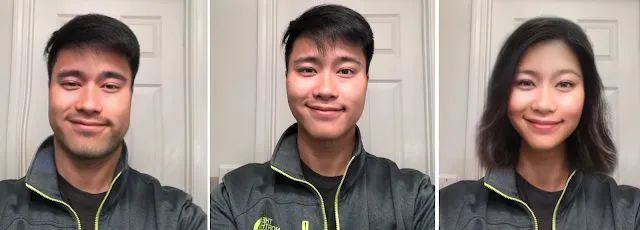 塌鼻梁鼻头大整容会有副作用吗,塌鼻梁凸嘴高颧骨整容