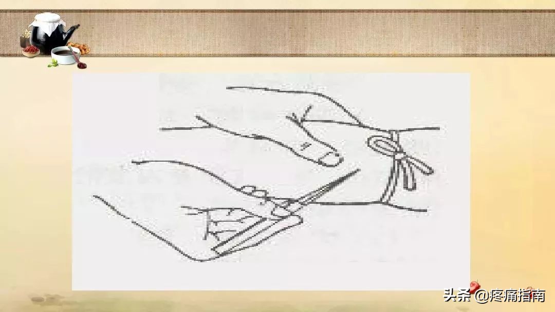 中医刺络放血疗法,中医刺络放血