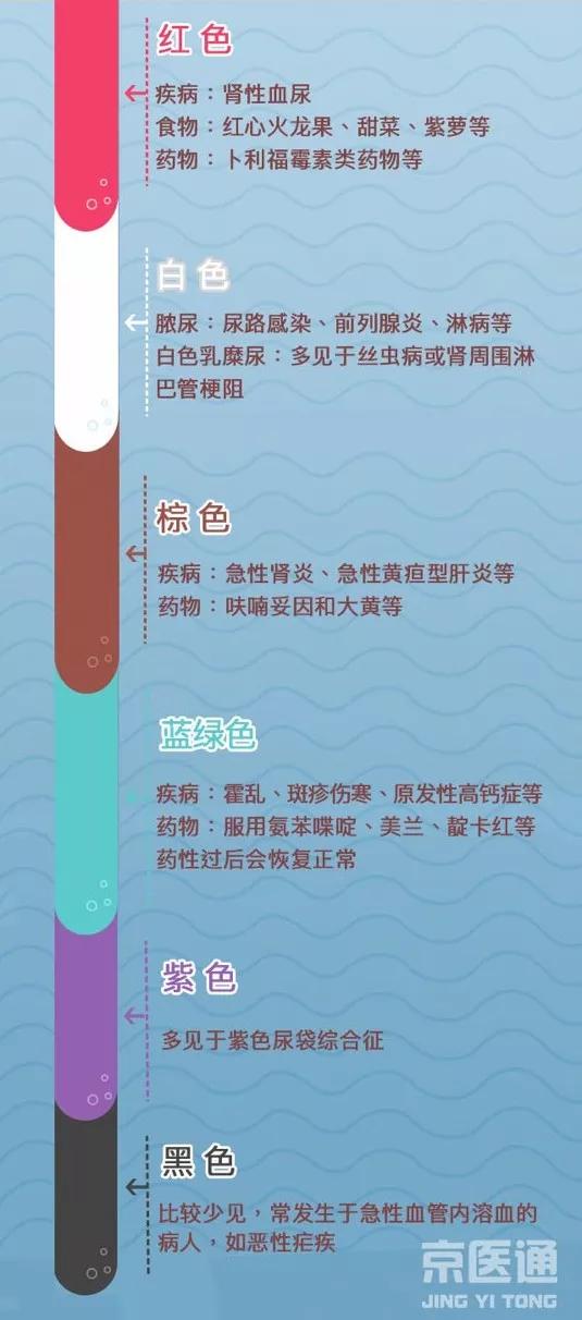 尿常规是属于什么科,尿常规指的是什么
