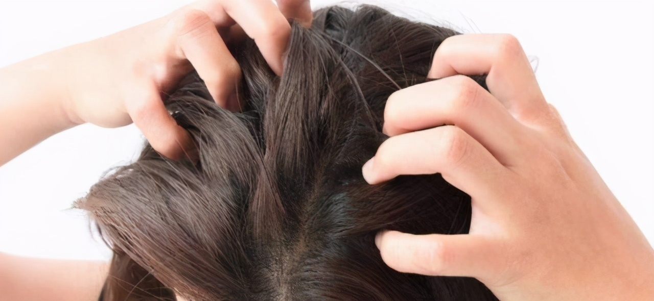 头上长头皮屑怎么办三分钟搞定,头上长凸起的疙瘩抠下来像头皮屑