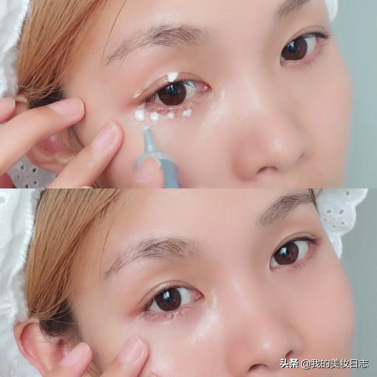 老人去眼袋妙招,老人去眼袋最有效的方法