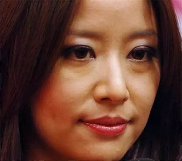 眼袋越来越严重赶紧试试这个方法,大家是否知道眼袋形成的原因呢