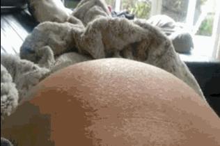 专家说：孕期羊水过多或过少，怎么办？