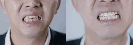 最好用的牙膏排行榜前十名,选哪个牌子的牙膏最安全好用