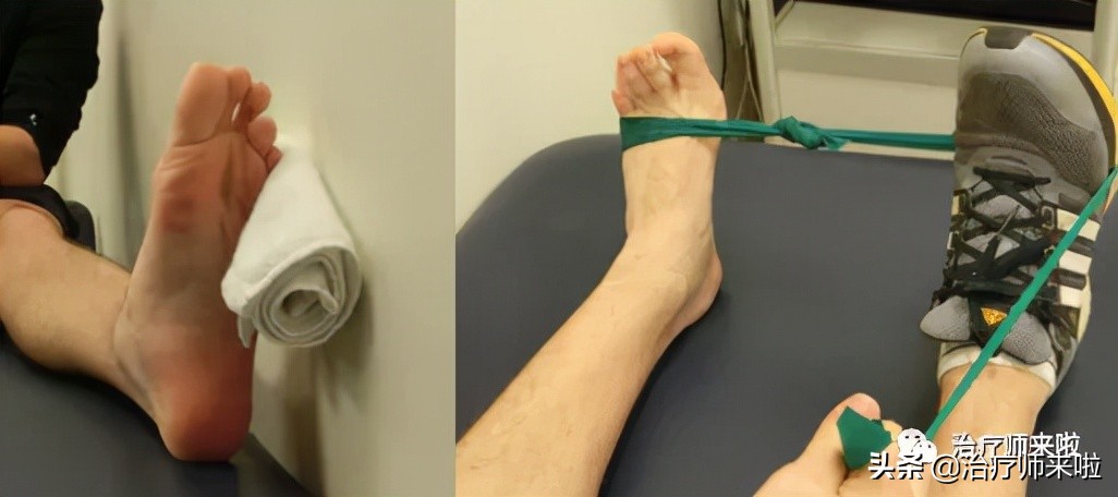 踝关节韧带重建康复北医三院,踝关节韧带重建手术后遗症