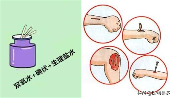 摔水泥地上擦伤会得破伤风吗,骑电车摔跤擦伤要打碎伤风吗