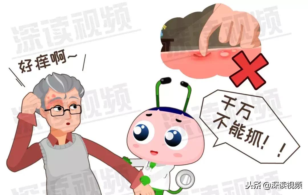 水痘和带状疱疹潜伏期是多久,得了水痘是不是容易得带状疱疹